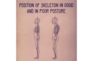Improving your posture